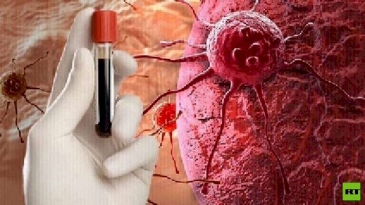 سرطان الثدي