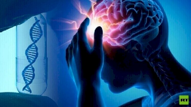 سكتة دماغية