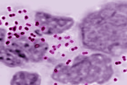 بكتيريا خطيرة عابرة للقارات.. تنتقل بشكل غريب!