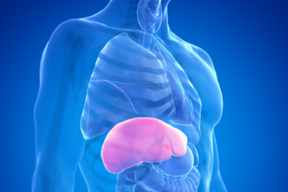 علامات بعضها يظهر على الجلد وتشير إلى مرحلة متقدمة من مرض الكبد الدهني