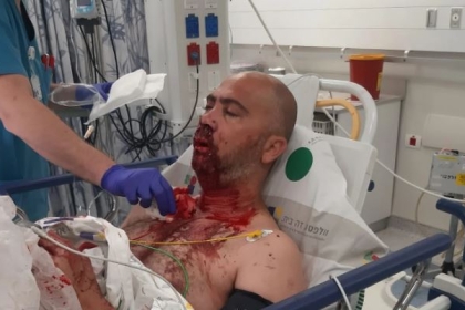 الاحتلال يغلق ملف التحقيق في إصابة شاب من يافا