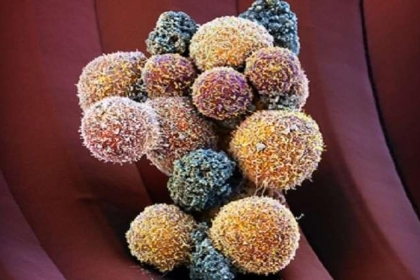 هل يساعد صيام رمضان على الوقاية من مرض السرطان؟