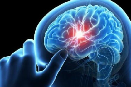 إليكم الحلول.. أسباب ازدياد السكتات الدماغية عند الشباب