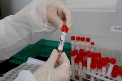 كيلة: تسجيل 255 إصابة جديدة بفيروس كورونا في الضفة الغربية