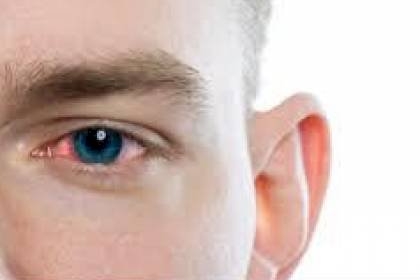 إليك 13 نصيحة لحماية عينك من المخاطر