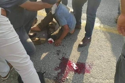 مستوطن يدهس طفلاً في الخليل ويصيبه بجروح