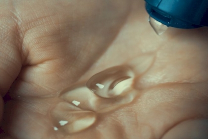 امرأة تصاب بحروق شديدة بعد اشتعال النيران في جلدها بسبب معقم اليدين (صور)