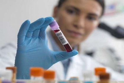 اكتشاف متغير نادر للدم يساعد في الوقاية من مرض يقتل نصف مليون شخص كل عام