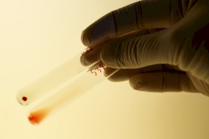 دراستان تكشفان عن فصيلة دم الأشخاص الأقل عرضة للإصابة بكورونا