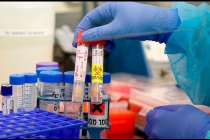 دراسة: جرعة مخفضة من الأسبرين قد تقلل خطر دخول العناية المركزة لمرضى كورونا