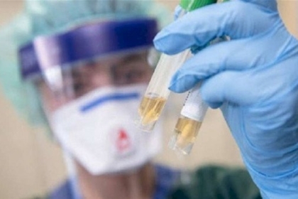 مصر تطلب توفير 50 مليون جرعة من القاح لمواجهة تفشي كورونا