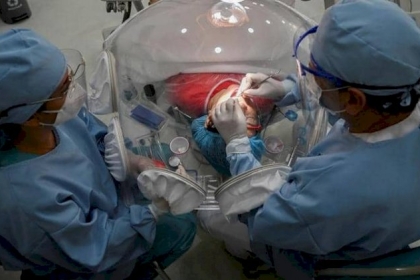 متعافون من كورونا يكشفون الصدمة: يتسبب بسقوط الأسنان