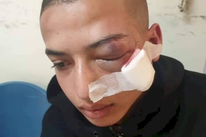 القدس: إصابة فتى برصاص الاحتلال في العيسوية