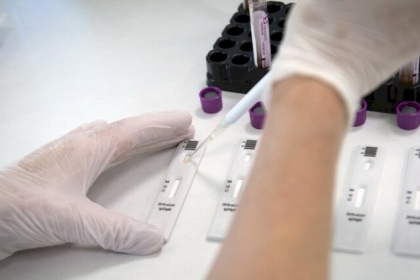 تسجيل نحو مليونين و660 ألف وفاة والإصابات تتخطى عتبة الـ120 مليونا بفيروس كورونا