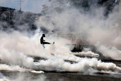 7 إصابات بالرصاص والاختناق في مواجهات مع الاحتلال في طولكرم