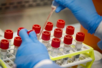 معطيات إسرائيلية: 80% من المصابين بفيروس كورونا مؤخرًا تعرضوا لمتحور BA.2