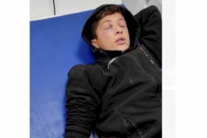 الاحتلال يعتدي على طالب مدرسة بالبيرة