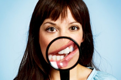 لماذا تظهر لدى البعض بقع بيضاء عنيدة على أسنانهم ولا تختفي أبدا؟