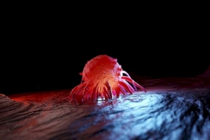 اكتشاف طريقة تخفّض خطر تطور السرطان بنسبة 60%