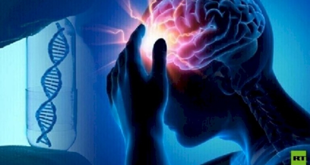 سكتة دماغية